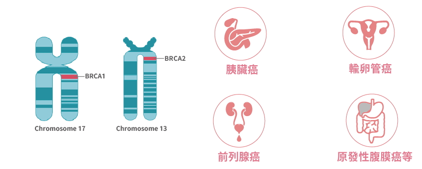 BRCA 基因與乳癌卵巢癌的風險